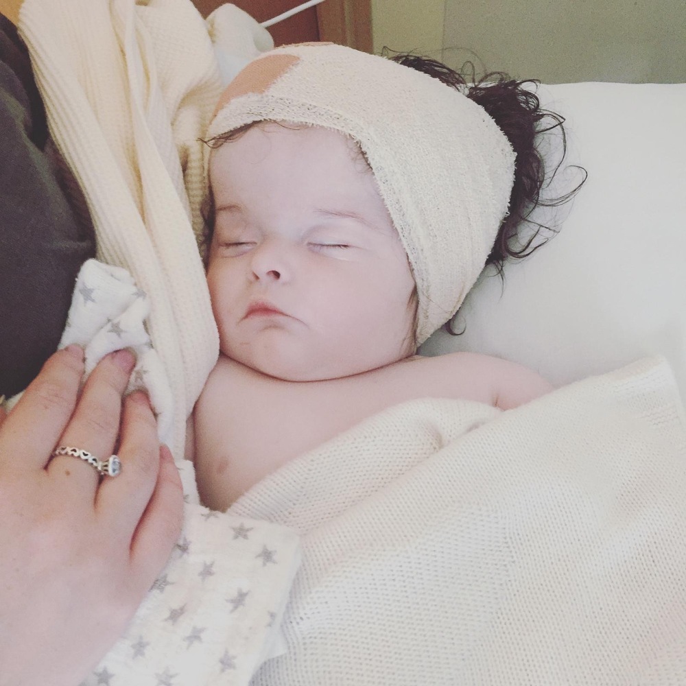 Baby girl recovering from surgery